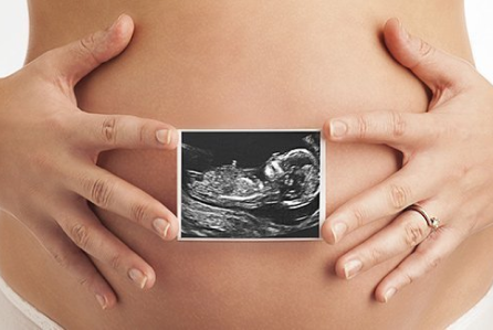 An ultrasound image of a pregnant womens belly