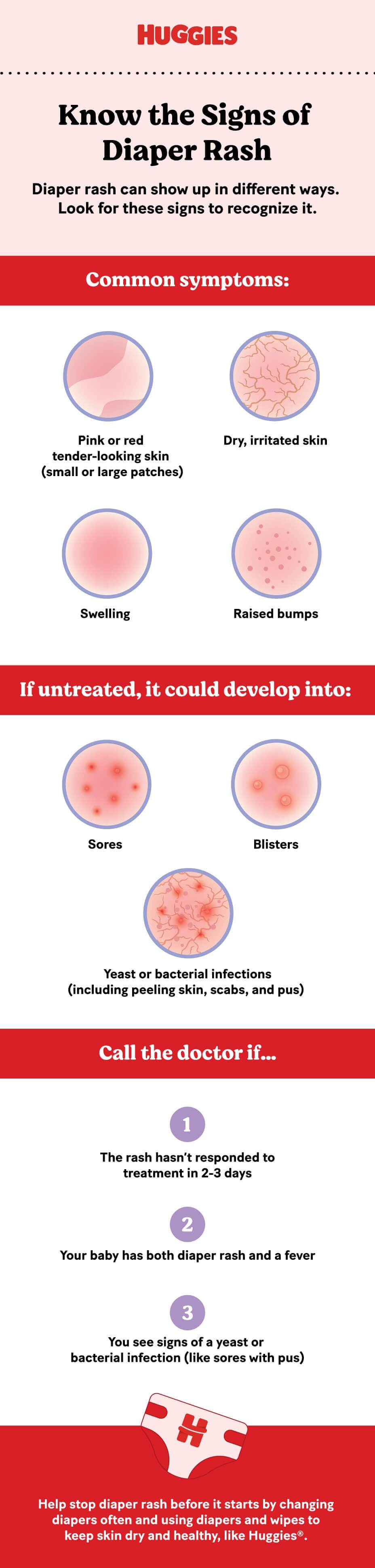 guía visual de la dermatitis del pañal
