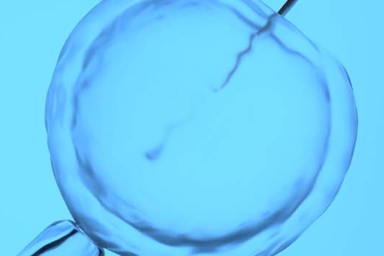 F0157