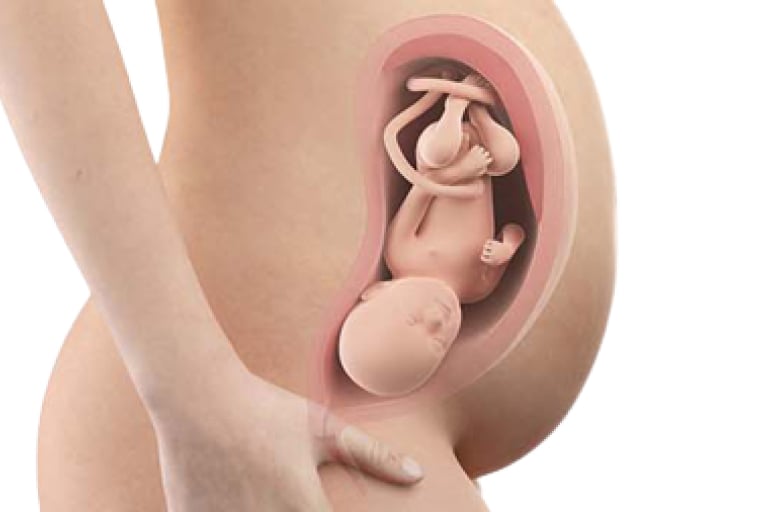 34 weeks pregnant